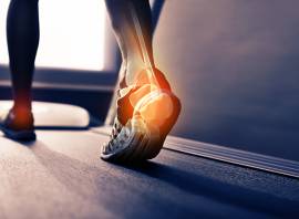 Why does the outside of my foot hurt when I run?