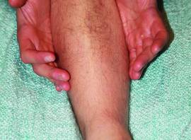 Self-massage: how to treat your aches and pains