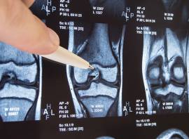 Diagnostic imaging: What’s the difference between X-ray, ultrasound and MRI?