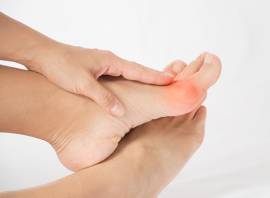 Bunions: what are they and is it ok to run with them?