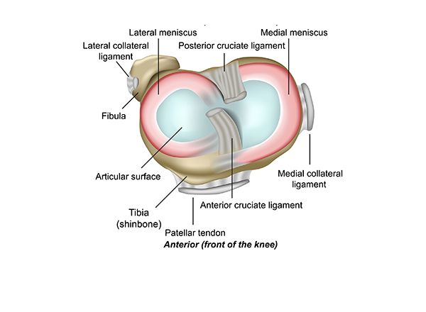What is a torn meniscus and how do you treat it?